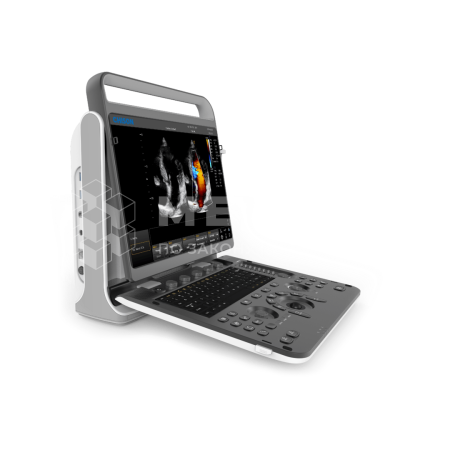Аппарат УЗИ (сканер) Chison SonoTouch 60 Pro