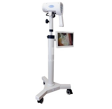 Компактный видеокольпоскоп UAB Biomedicinos Technika ALScope SLV-101 HDM на прямой стойке