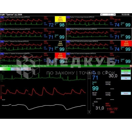 Станция мониторная центральная Treaton СЦМ2.22
